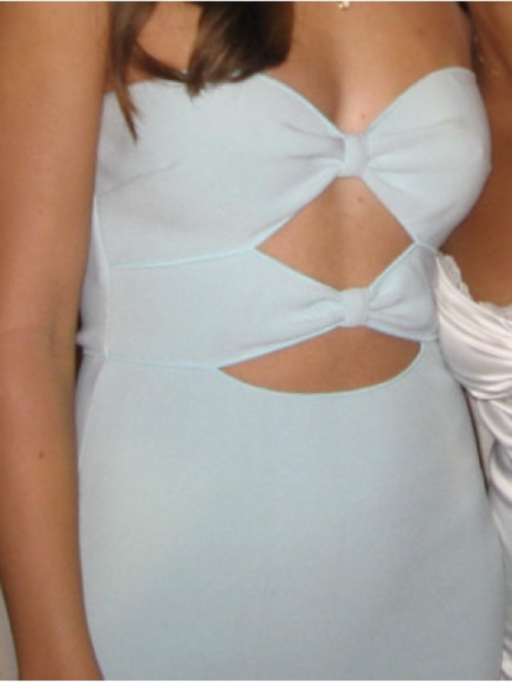 Light Blue Cutout Mini Dress